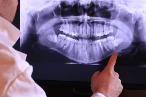 Best Emergency Dentist for Lost Fillings or Crowns in Lawton, OK
