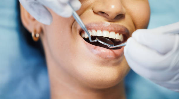 Best Emergency Dentist for Special Needs Patients in Lawton, OK